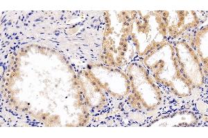 Immunohistochemistry (IHC) image for anti-Ribosomal Protein S6 Kinase, 70kDa, Polypeptide 1 (RPS6KB1) (AA 91-352) antibody (ABIN7430135)