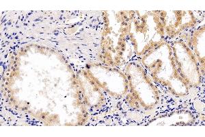 Detection of RPS6Kb1 in Human Kidney Tissue using Polyclonal Antibody to Ribosomal Protein S6 Kinase Beta 1 (RPS6Kb1) (RPS6KB1 Antikörper  (AA 91-352))