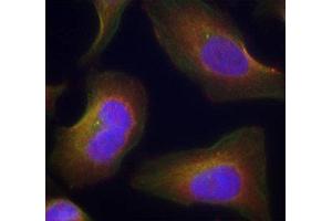 Immunofluorescence staining of methanol-fixed Hela cells using Phospho-PRKCQ-S676 antibody. (PKC theta Antikörper  (pSer676))