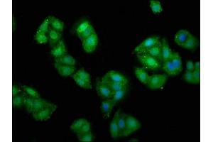 Immunofluorescence staining of HepG2 cells with ABIN7152277 at 1:135, counter-stained with DAPI. (Exopolyphosphatase PRUNE1 (PRUNE1) (AA 1-168) Antikörper)