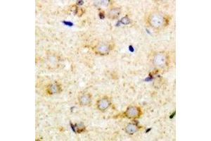 Immunohistochemical analysis of Pumilio 1 staining in mouse brain formalin fixed paraffin embedded tissue section.