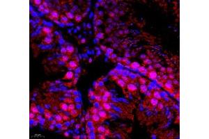 Immunofluorescence of paraffin embedded mouse testis using DMRTA2 (ABIN7073753) at dilution of 1: 650 (400x lens) (DMRTA2 Antikörper)