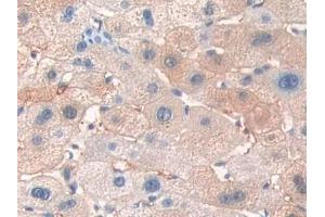 IHC-P analysis of Human Liver Tissue, with DAB staining. (ERBB3 Antikörper  (AA 709-966))