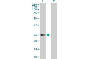 Western Blot analysis of CCBL1 expression in transfected 293T cell line by CCBL1 MaxPab polyclonal antibody. (CCBL1 Antikörper  (AA 1-250))