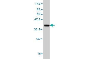 Western Blot detection against Immunogen (36. (EPH Receptor A4 Antikörper  (AA 887-986))