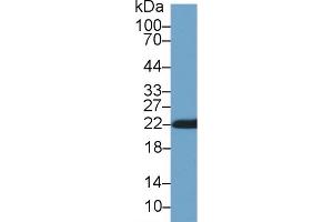 Western Blot; Sample: Rat Skin lysate; Primary Ab: 1µg/ml Rabbit Anti-Rat CYPB Antibody Second Ab: 0. (PPIB Antikörper  (AA 34-216))