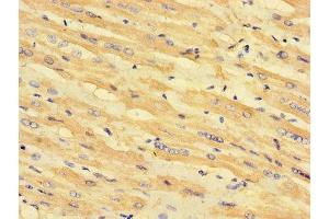 Immunohistochemistry of paraffin-embedded human heart tissue using ABIN7158953 at dilution of 1:100 (MLYCD Antikörper  (AA 40-493))