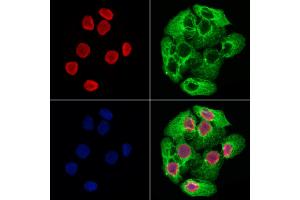 ABIN6265232 and ABIN6278671 staining Hela cells by IF/ICC. (SOX12 Antikörper  (Internal Region))
