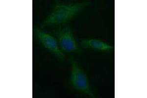 Image no. 2 for anti-Tyrosine Hydroxylase (TH) antibody (ABIN1501369) (Tyrosine Hydroxylase Antikörper)