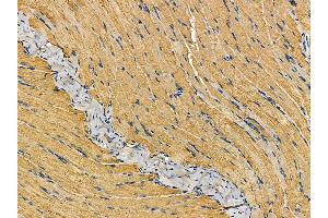 ABIN7095237 and ABIN7099294 at 1/100 staining rat muscle tissue by IHC-P.