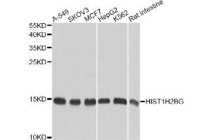 Western blot analysis of extracts of various cell lines, using HIST1H2BG antibody (ABIN6003628) at 1/1000 dilution. (HIST1H2BG Antikörper)