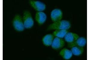 IF analysis of VAV3 using anti-VAV3 antibody (ABIN7601922).