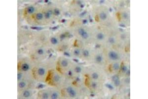 Used in DAB staining on fromalin fixed paraffin-embedded Liver tissue (CD36 Antikörper  (AA 91-311))