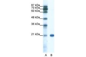 SSX2 antibody used at 0.