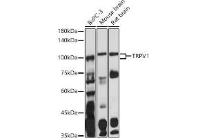 Western blot analysis of extracts of various cell lines, using TRPV1 antibody (ABIN6133947, ABIN6149596, ABIN6149597 and ABIN6224662) at 1:1000 dilution. (TRPV1 Antikörper  (AA 400-500))