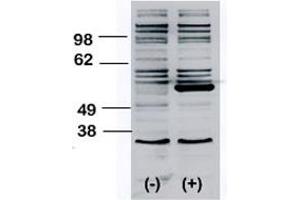 Western blot analysis of BLK polyclonal antibody  transiently transfected HEK293 cell line lysate (1 ug/lane). (BLK Antikörper  (N-Term))