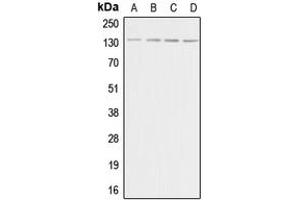 Western blot analysis of Adenylate Cyclase 5/6 expression in HeLa (A), Raw264. (ADCY5/6 Antikörper  (C-Term))