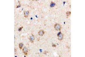 Immunohistochemical analysis of BCS1L staining in rat brain formalin fixed paraffin embedded tissue section. (BCS1L Antikörper)