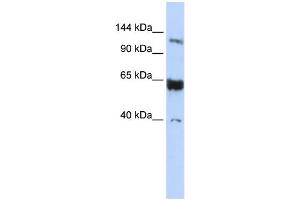 WB Suggested Anti-SYCP1 Antibody Titration: 0.