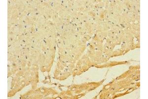 Immunohistochemistry of paraffin-embedded human heart tissue using ABIN7174908 at dilution of 1:100