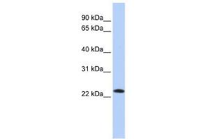 SDF2 antibody used at 1 ug/ml to detect target protein. (SDF2 Antikörper  (Middle Region))