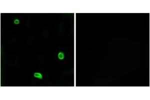 Immunofluorescence analysis of LOVO cells, using PAR4 Antibody.