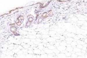 Immunohistochemistry analysis of paraffin-embedded mouse skin using,ECRG-2 (ABIN7075552) at dilution of 1: 2600 (SPINK7/ECRG2 Antikörper)
