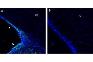 anti-Solute Carrier Family 22 Member 5 (SLC22A5) (AA 540-554), (C-Term), (Intracellular) antibody