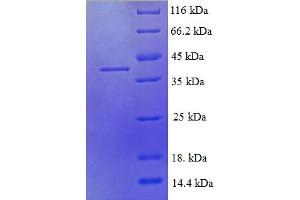 SDS-PAGE (SDS) image for Chemokine (C-C Motif) Ligand 21 (CCL21) (AA 24-134) protein (GST tag) (ABIN5709217)