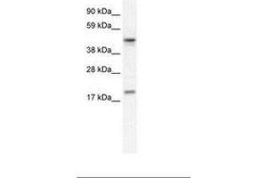 Image no. 1 for anti-Programmed Cell Death 4 (PDCD4) (N-Term) antibody (ABIN6735963) (PDCD4 Antikörper  (N-Term))