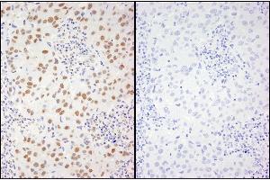 Immunohistochemistry (IHC) image for anti-X-Ray Repair Complementing Defective Repair in Chinese Hamster Cells 1 (XRCC1) (pSer461) antibody (ABIN7448870)
