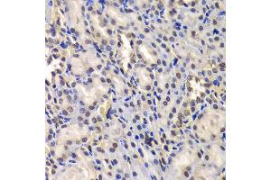 Immunohistochemistry of paraffin-embedded Rat kidney using DDX41 antibody at dilution of 1:100 (x400 lens). (DDX41 Antikörper)