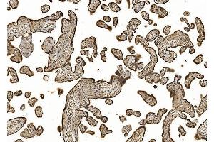 IHC analysis of EIF5 using anti-EIF5 antibody (ABIN7599722).