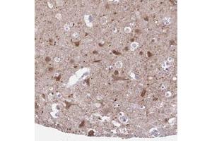 Immunohistochemical staining (Formalin-fixed paraffin-embedded sections) of human cerebral cortex with DCLK2 polyclonal antibody  shows moderate cytoplasmic positivity in neuronal cells at 1:50-1:200 dilution. (DCLK2 Antikörper)