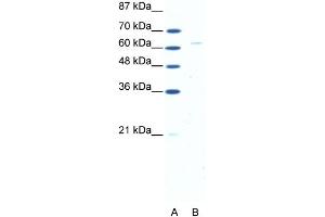WB Suggested Anti-FOXN1 Antibody Titration: 5. (FOXN1 Antikörper  (N-Term))