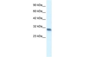 Western Blotting (WB) image for anti-Four and A Half LIM Domains 2 (FHL2) antibody (ABIN2460972)