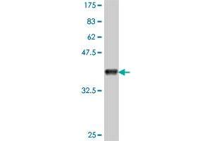 Western Blot detection against Immunogen (37. (CACUL1 Antikörper  (AA 111-210))