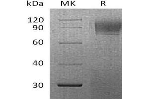 Western Blotting (WB) image for Interferon alpha/beta Receptor 1 (IFNAR1) protein (His tag) (ABIN7320999)