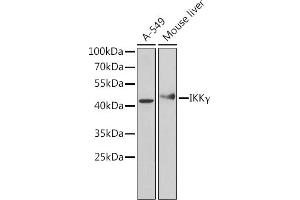 Western blot analysis of extracts of various cell lines, using IKKγ Antibody (ABIN6130478, ABIN6142284, ABIN6142286 and ABIN7101404) at 1:1000 dilution.
