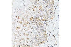 Immunohistochemistry (IHC) image for anti-Glutamate-Ammonia Ligase (GLUL) (AA 1-373) antibody (ABIN6141161)