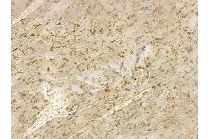 MYLK2 Mouse Monoclonal Antibody at 1/100 staining mouse heart tissue by IHC-P. (MYLK2 Antikörper  (Internal Region))