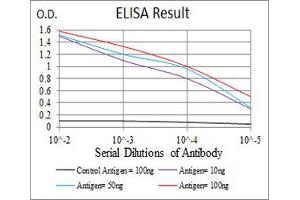 Black line: Control Antigen (100 ng), Purple line: Antigen(10 ng), Blue line: Antigen (50 ng), Red line: Antigen (100 ng), (LDLR Antikörper  (AA 22-150))