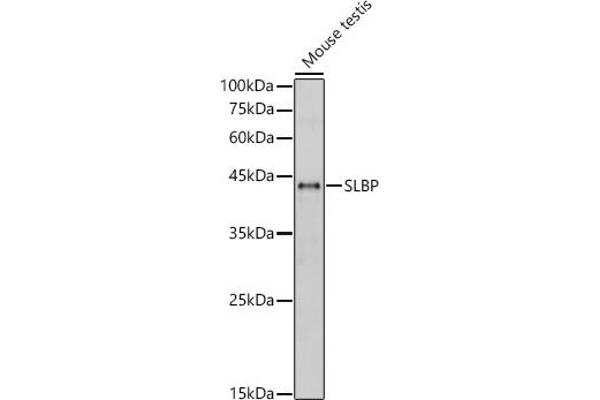 SLBP Antikörper