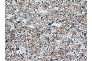 Immunohistochemical staining of paraffin-embedded Human liver tissue using anti-C9orf41 mouse monoclonal antibody. (C9orf41 Antikörper)