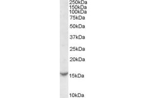 Western Blotting (WB) image for anti-DENN/MADD Domain Containing 5A (DENND5A) (N-Term) antibody (ABIN2786091) (DENND5A Antikörper  (N-Term))