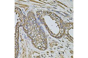 Immunohistochemistry of paraffin-embedded human prostate using CPOX antibody (ABIN5971997) at dilution of 1/100 (40x lens). (CPOX Antikörper)