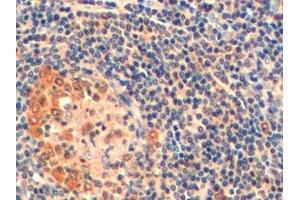 Immunohistochemistry (IHC) image for anti-Thymidylate Synthetase (TYMS) (AA 36-313) antibody (ABIN7436399)