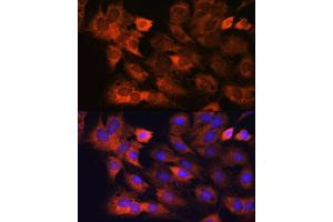 Immunofluorescence analysis of C6 cells using RPS8 antibody (ABIN7270041) at dilution of 1:100. (RPS8 Antikörper)