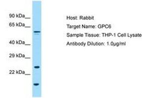 Image no. 1 for anti-Glypican 6 (GPC6) (AA 36-85) antibody (ABIN6749994) (Glypican 6 Antikörper  (AA 36-85))