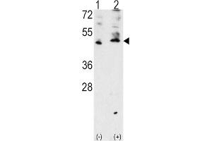 Western Blotting (WB) image for anti-Vascular Endothelial Growth Factor C (VEGFC) antibody (ABIN3001426) (VEGFC Antikörper)
